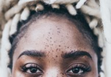 6 Natural Remedies for Dark Spots