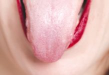 16 Home Remedies for Tongue Blisters human tongue