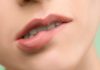 6 Home Remedies to Cure White Spots on Lips woman`s lips