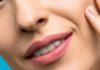 10 Ways to Get Rid of Blackheads on the Nose woman`s nose
