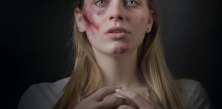 Wound Infection wound
