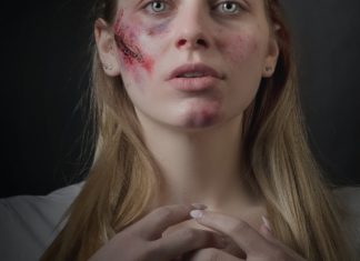 Wound Infection wound