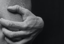 How To Treat Hives scratching skin