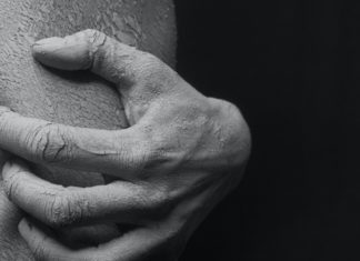 The Rare Skin Disease Called Yaw scratching skin