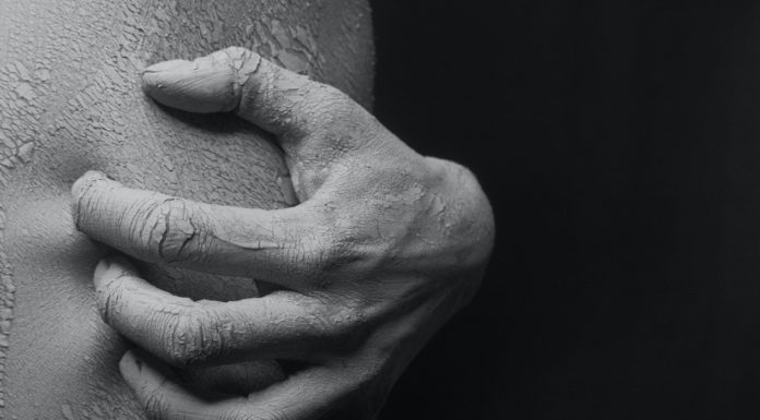 How To Treat Hives scratching skin