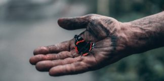 Burns: First Aid, Home Remedy, Clearing Scars hands with smoke