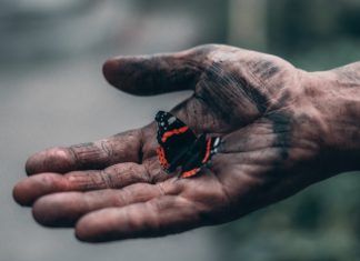 Burns: First Aid, Home Remedy, Clearing Scars hands with smoke