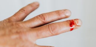 How to Treat Stings and Bites At Home could be a snake bite
