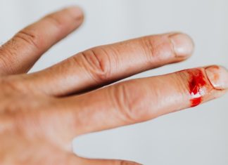 How to Treat Stings and Bites At Home could be a snake bite