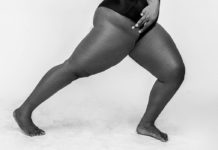 Treatments for Bad Posture poor pose