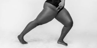 Treatments for Bad Posture poor pose