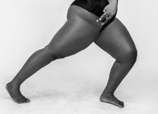 Treatments for Bad Posture poor pose