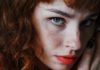 Bell’s Palsy: Causes, Symptoms & Treatment face