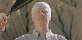 Things You Should Know About Albinism