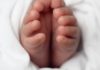 Crooked Toes: Types, Causes, and Treatment curly toes
