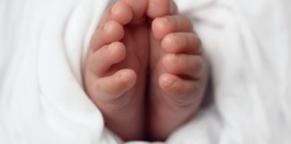 Crooked Toes: Types, Causes, and Treatment curly toes