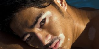 Skin Disorders and Treatment Skin disorder