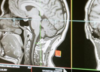 17 Habits that Damage the Brain brain