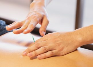 13 Health benefits of Acupuncture therapy
