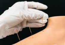 What Can Moxibustion Therapy Offer Your Health? acupuncture