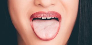 Here`s What to Know About Bad Breath tongue