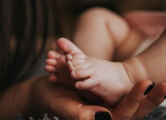 Clubfoot Symptoms, Causes, Prevention, And Treatment a child's foot