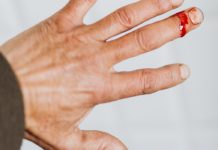 Hemophilia: Causes, Symptoms & Treatment hemophilia