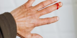 Hemophilia: Causes, Symptoms & Treatment hemophilia