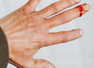 Hemophilia: Causes, Symptoms & Treatment hemophilia