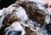 Causes of Sores and Scabs on the Scalp hair