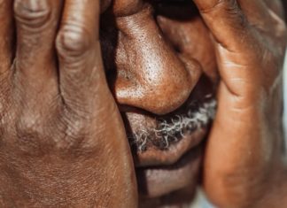 Does Stroke Cause Dementia? Does Stroke Cause Dementia?