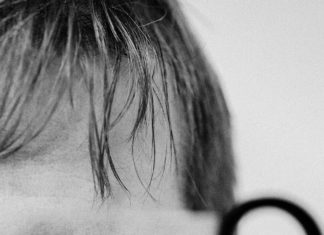 All to Know About Multiple Sclerosis (MS) All to Know About Multiple Sclerosis (MS)