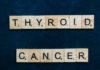Diagnosis and Treatment of Hyperthyroidism Diagnosis and Treatment of Hyperthyroidism