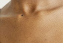 Let’s Talk About Pruritus (Itchiness) itchy skin