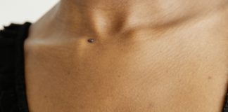 Let’s Talk About Pruritus (Itchiness) itchy skin