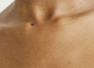 Let’s Talk About Pruritus (Itchiness) itchy skin