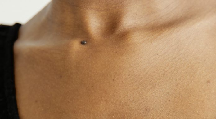 Let’s Talk About Pruritus (Itchiness) itchy skin