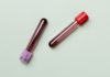 Natural Remedies for Blood Shortage Natural Remedies for Blood Shortage