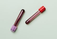 Natural Remedies for Blood Shortage Natural Remedies for Blood Shortage