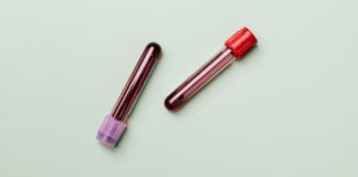 Natural Remedies for Blood Shortage Natural Remedies for Blood Shortage