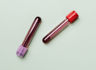 Natural Remedies for Blood Shortage Natural Remedies for Blood Shortage