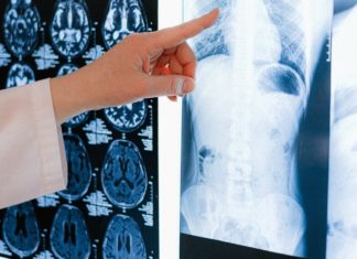 Keeping Your Lungs Healthy During COVID Keeping Your Lungs Healthy During COVID