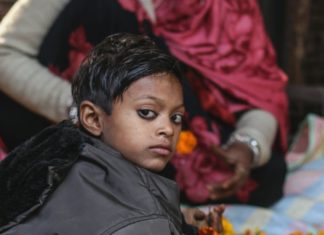 Incredible Health Benefit of Stinking Toe Incredible Health Benefit of Stinking Toe