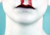 Home Remedies for Nosebleeds Home Remedies for Nosebleeds