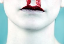 Home Remedies for Nosebleeds Home Remedies for Nosebleeds