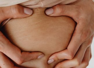 6 Essential Oils for Stretch Marks Removal 6 Essential Oils for Stretch Marks Removal