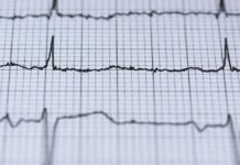 Tachycardia: Causes, Symptoms, Treatment Tachycardia: Causes, Symptoms, Treatment