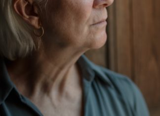 6 Natural Remedies for Chafed Skin natural remedies for chafed skin