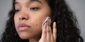 5 Natural Remedies for Ringworm ringworm remedies